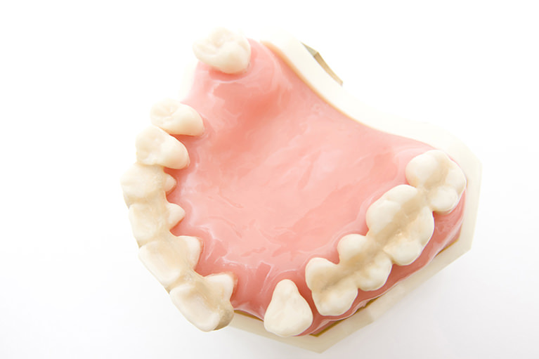 歯周病　～歯を残すために、早期治療を～